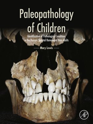 cover image of Paleopathology of Children
